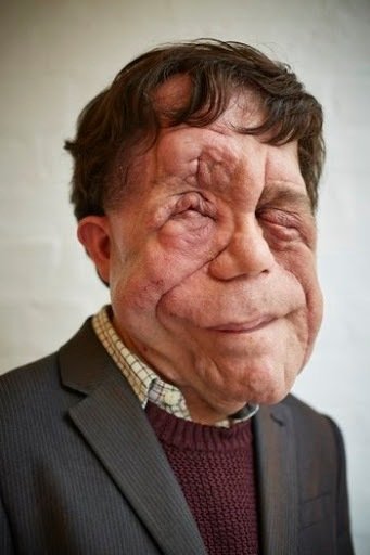Adam Pearson - headshot